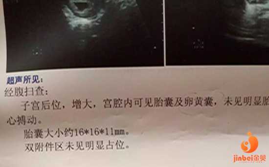 南京医院可以代生,【南京试管供卵机构供卵对人体有伤害吗】孕周33周 妈咪今