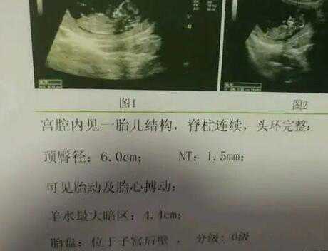 南京代孕2021 南京试管婴儿医院排名，附南京试管婴儿