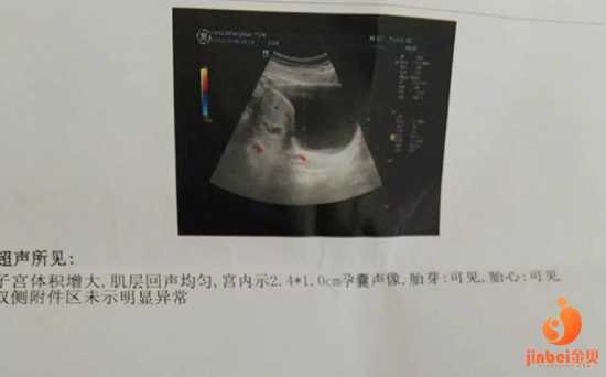 南京哪里可以代生,【南京市妇幼供卵试管45岁供卵成功率】因为是顺转刨意外情